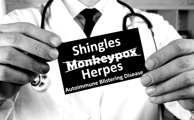 Monkeypox is a coverup for damage done to Immune System by COVID Vaccination resulting in Shingles, Autoimmune Blistering Disease & Herpes Infection