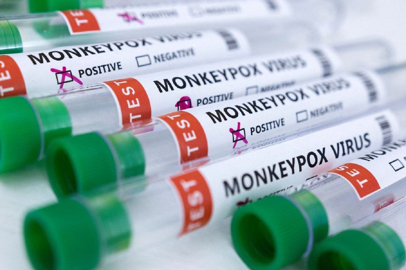 Monkeypox is following the Covid playbook step by step